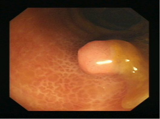 ������ѩ���ǿ�ѡ200%�Ƕ� ��ɼ���ŵ���������ƽ̨