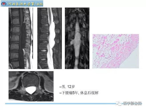 朱丽亚艾滋病本人照片 朱丽亚艾滋病本人照片
