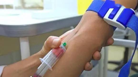 艾滋病的发病机制有哪些 艾滋病的发病机制有哪些