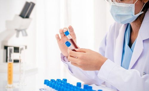 眼睛里面有血丝是怎么回事 眼睛里面有血丝是怎么回事