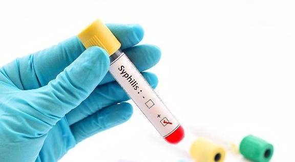 局部牙龈出血是什么病征兆 局部牙龈出血是什么病征兆