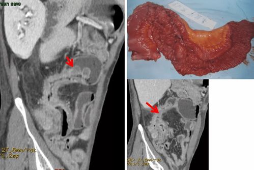 梅毒的传染性有哪些 梅毒的传染性有哪些