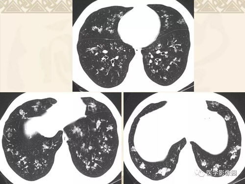 ��鰬�̲�Ӧ�� ��鰬�̲��������Ǹ�ҽԺ��