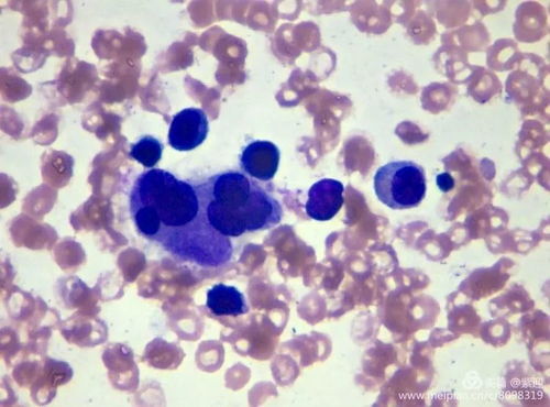 感染一期梅毒的原因都有哪些 感染一期梅毒的原因都有哪些