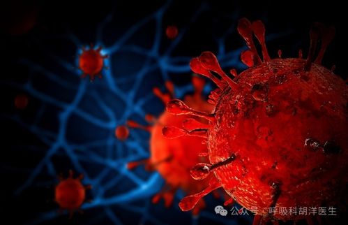 古代艾滋病传染吗 古代把艾滋病叫什么名字 古代艾滋病传染吗 古代把艾滋病叫什么名字