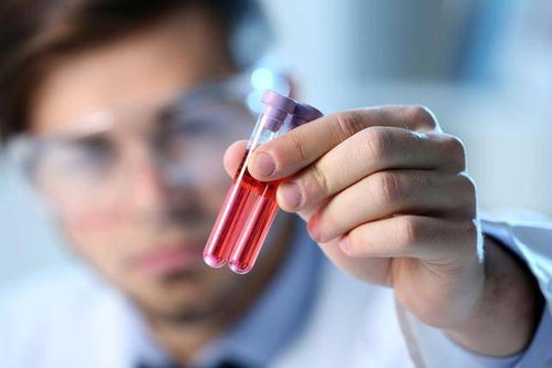 得了艾滋病等于判死刑吗 得了艾滋病等于判死刑吗