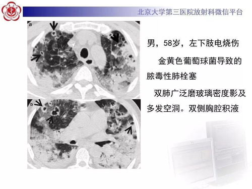 ��ˮ�������ܲ���ô����