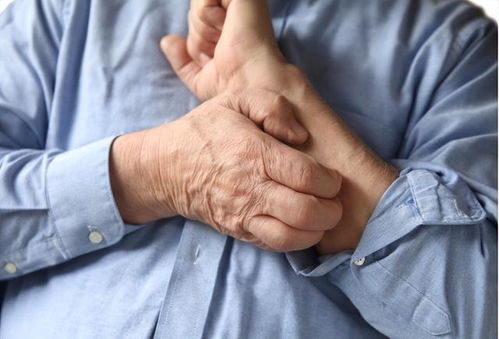 脏手抓破皮肤会感染艾滋病吗 脏手抓破皮肤会感染艾滋病吗