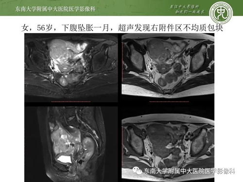 艾滋病不可以吃红柚吗 艾滋病不可以吃红柚吗