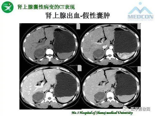 sj成员关系(sj成员都有谁谈恋爱了) sj成员关系(sj成员都有谁谈恋爱了)