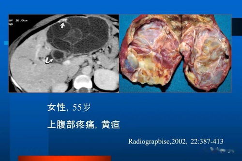 各期梅毒的临床症状 各期梅毒的临床症状