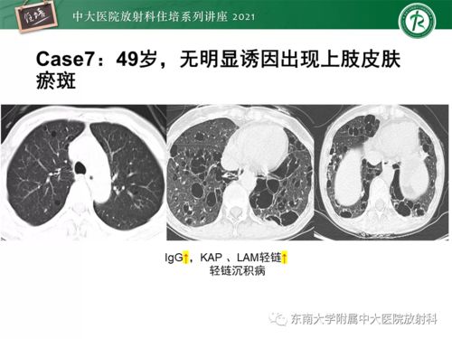 2025年世界艾滋病日时间是几号 农历十月十七12月 2025年世界艾滋病日时间是几号 农历十月十七12月