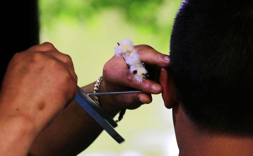 口甜会不会传染艾滋病 口甜会不会传染艾滋病