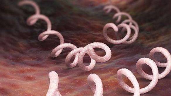 牙龈老是爱出血是什么原因 牙龈老是爱出血是什么原因