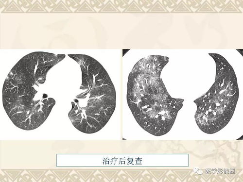 临海艾滋病试纸 艾滋试纸多少钱 临海艾滋病试纸 艾滋试纸多少钱