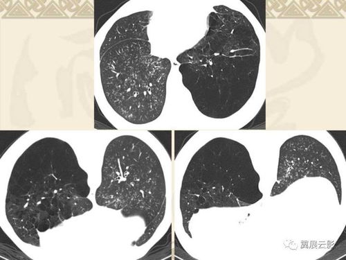 ÷���Ļ�����ʩ������Щ