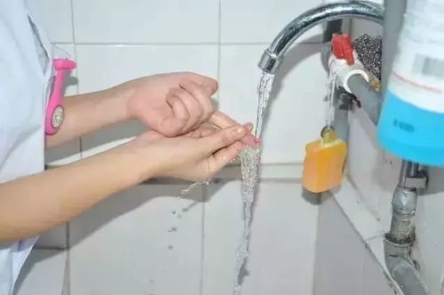 安徽治性病好的医院 梅毒是怎么传播的 安徽治性病好的医院 梅毒是怎么传播的