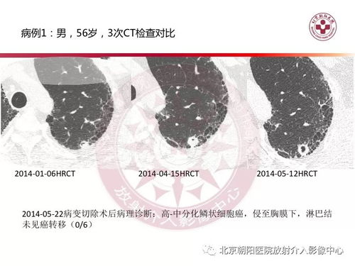 Ϊʲô���������� ����Ⱦ�ϰ��̲� ��4�������׸�Ⱦ����