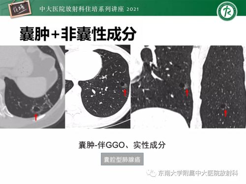 怎么查得出艾滋病(怎么查出艾滋病吗) 怎么查得出艾滋病(怎么查出艾滋病吗)