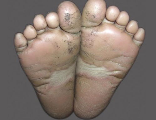 没有艾滋病可以办理艾滋病证么 没有艾滋病可以办理艾滋病证么