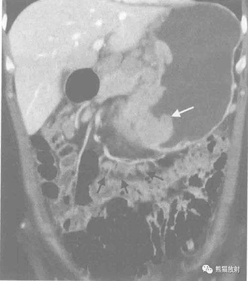 与梅毒患者在一起哪些生活注意事项 与梅毒患者在一起哪些生活注意事项