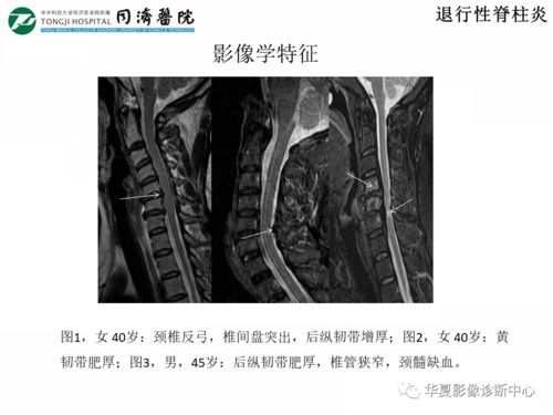 ���̲��񻯺���ʲôΣ��