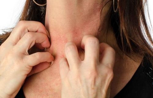 梅毒最低是多少(梅毒打一针多少钱) 梅毒最低是多少(梅毒打一针多少钱)