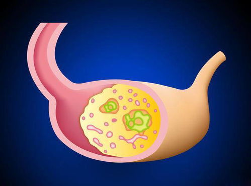 什么食物对艾滋病有益 盘点6种食物有助预防艾滋病 什么食物对艾滋病有益 盘点6种食物有助预防艾滋病