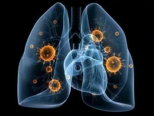 女性梅毒的早期症状有哪些 女性梅毒的早期症状有哪些