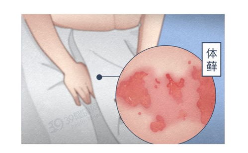 国乒8比1击败日本队11战全胜夺冠 真正的考验在赛后 国乒8比1击败日本队11战全胜夺冠 真正的考验在赛后