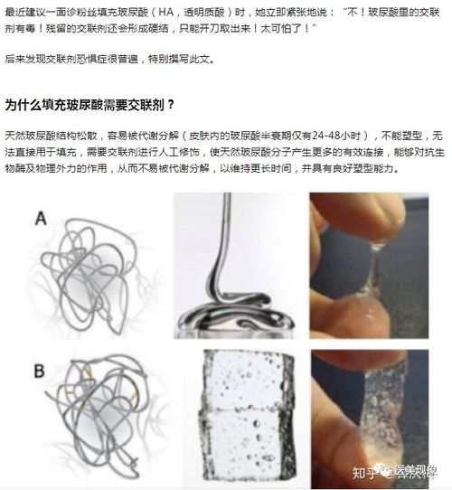 肛门坠胀都有什么原因引起的 肛门坠胀都有什么原因引起的