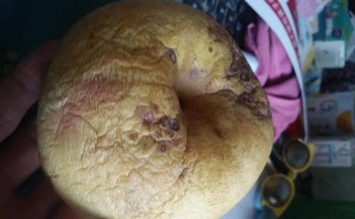 �ܲ���÷������ʲô��Ⱦ