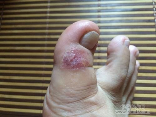 ÷�������ȳ��� ÷��һ��ʼ����������