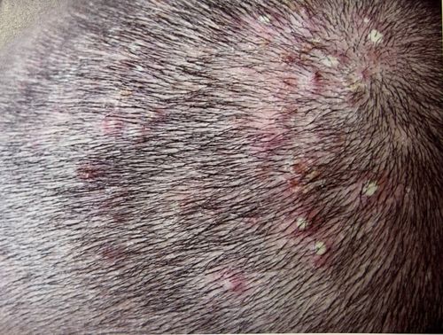 ��Զ���� ��Զ��������˻���ô��