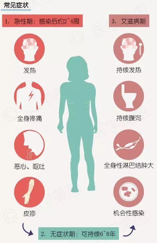 大退刺痛是有艾滋病吗 大退刺痛是有艾滋病吗