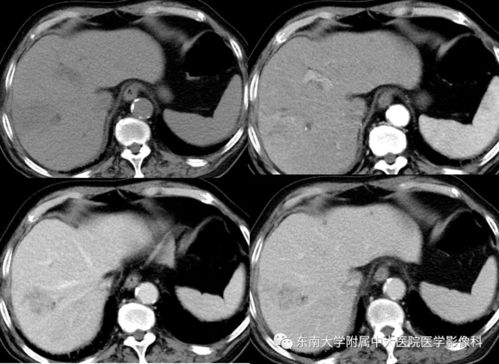 Ů�԰��̲�������Ǯ