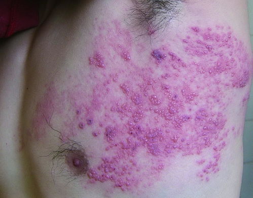 陈竺颁发艾滋病防治国际合作突出贡献奖 陈竺颁发艾滋病防治国际合作突出贡献奖