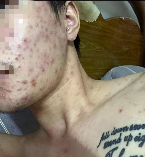 美国艾滋病研究团队数量 美国艾滋病研究团队数量