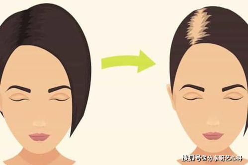 各种梅毒产生的原因有哪些 各种梅毒产生的原因有哪些