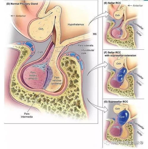 ����֧���ͺ� ����֧���ͺųߴ�