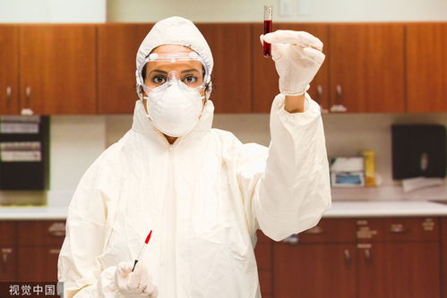 艾滋病病毒体外存活时间 hiv病毒离开人体能存活多久 艾滋病病毒体外存活时间 hiv病毒离开人体能存活多久